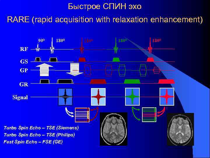 Быстрое СПИН эхо RARE (rapid acquisition with relaxation enhancement) 90° 180° RF GS GP
