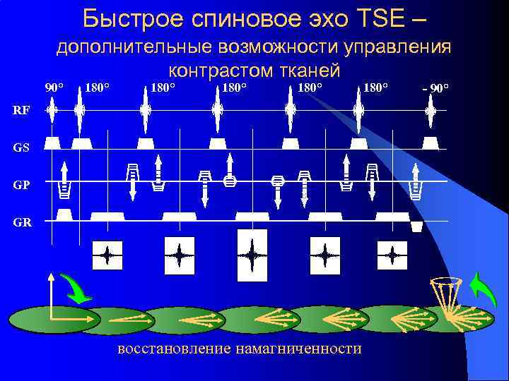 Быстрое спиновое эхо TSE – дополнительные возможности управления контрастом тканей 90° 180° RF GS