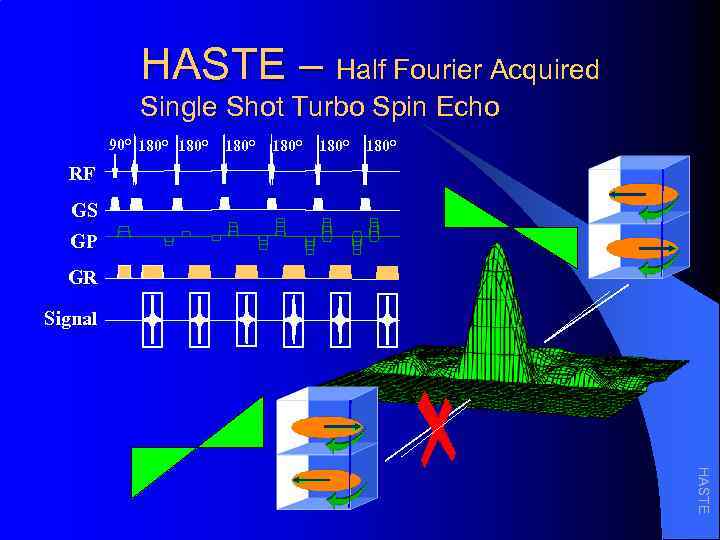 HASTE – Half Fourier Acquired Single Shot Turbo Spin Echo 90° 180° 180° RF