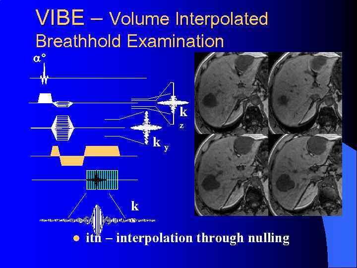 VIBE – Volume Interpolated Breathhold Examination a° k z k y k x l
