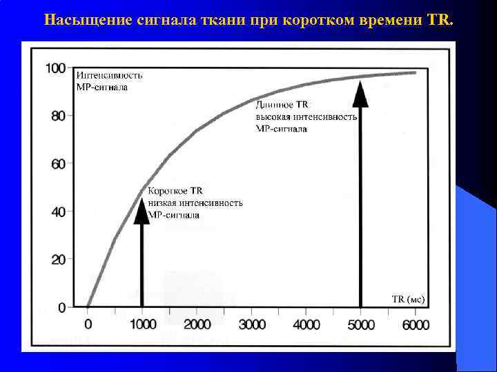 Насыщение сигнала ткани при коротком времени TR. 
