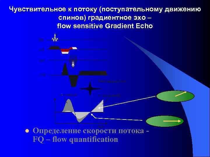 Чувствительное к потоку (поступательному движению спинов) градиентное эхо – flow sensitive Gradient Echo l