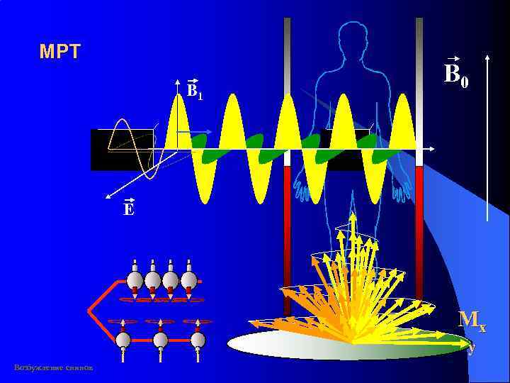 MР T B 1 B 0 E Mx y Возбуждение спинов 
