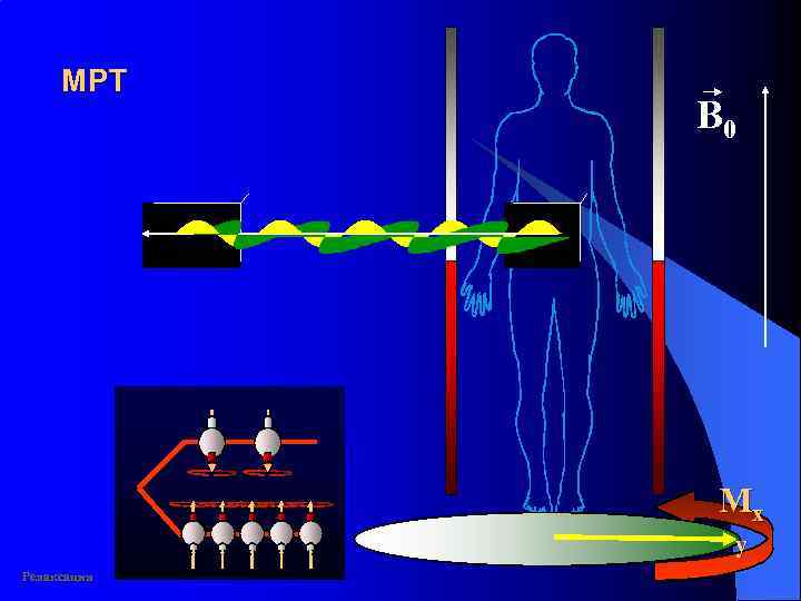 MР T B 0 Mx y Релаксация 