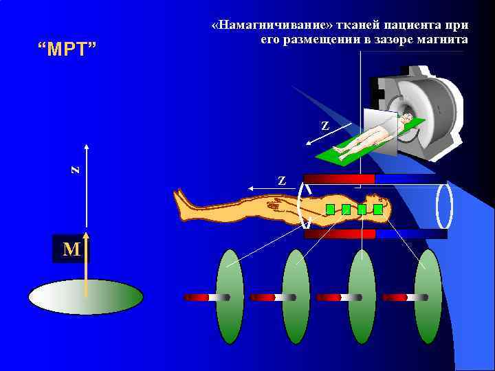 “МРТ” «Намагничивание» тканей пациента при его размещении в зазоре магнита Z z z Z