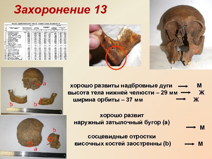 Захоронение 13 a b хорошо развиты надбровные дуги высота тела нижней челюсти – 29