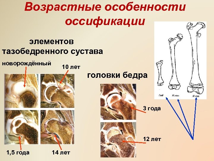 Возрастные особенности осcификации элементов тазобедренного сустава новорождённый 10 лет головки бедра 3 года 12