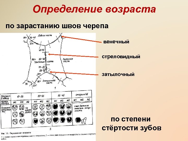 Определение возраста по зарастанию швов черепа венечный стреловидный затылочный по степени стёртости зубов 