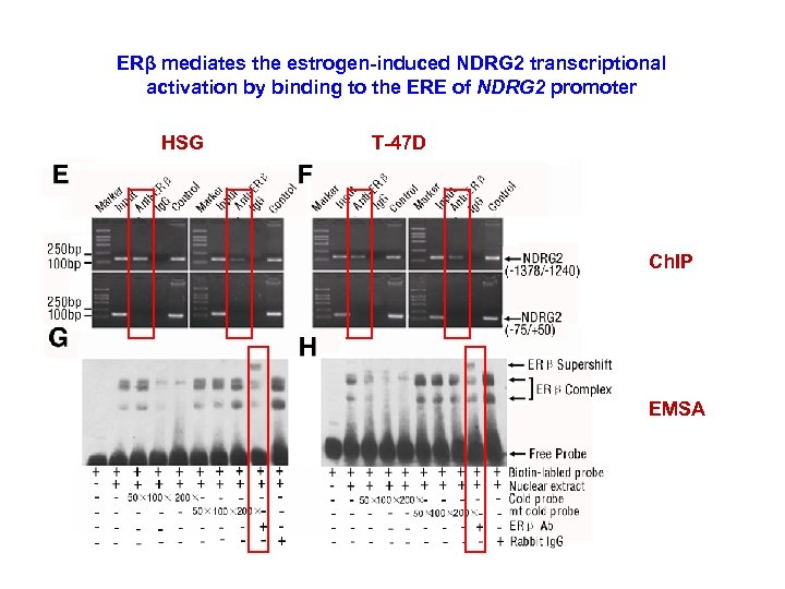 ERβ mediates the estrogen-induced NDRG 2 transcriptional activation by binding to the ERE of