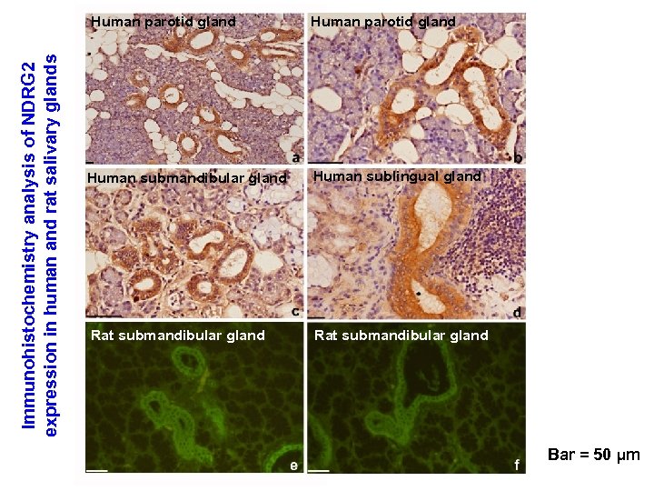 Immunohistochemistry analysis of NDRG 2 expression in human and rat salivary glands Human parotid