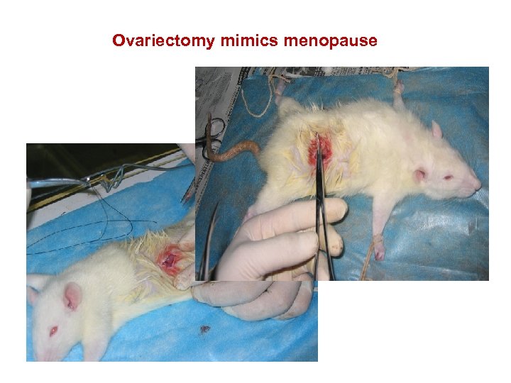 Ovariectomy mimics menopause 