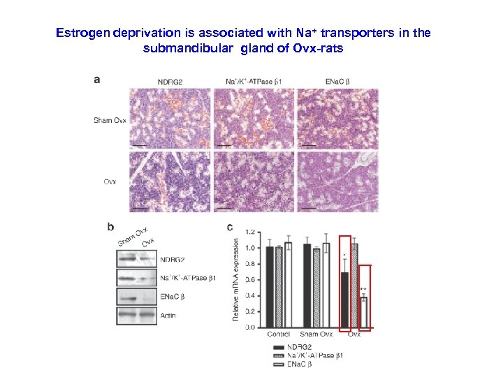 Estrogen deprivation is associated with Na+ transporters in the submandibular gland of Ovx-rats 