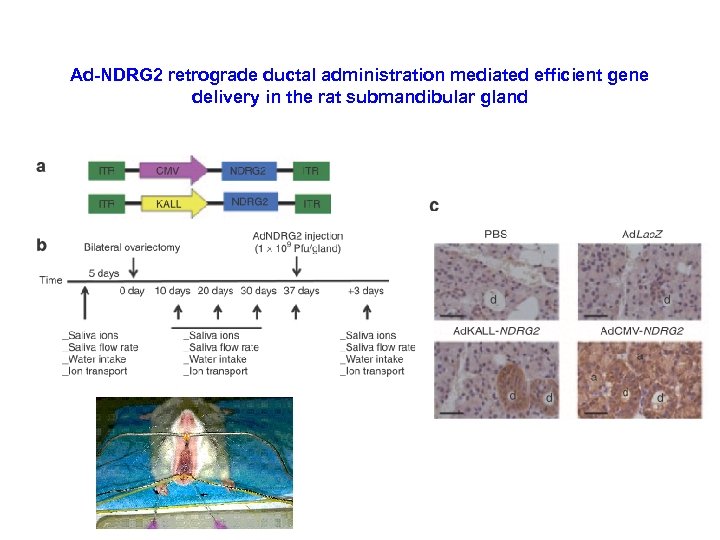 Ad-NDRG 2 retrograde ductal administration mediated efficient gene delivery in the rat submandibular gland