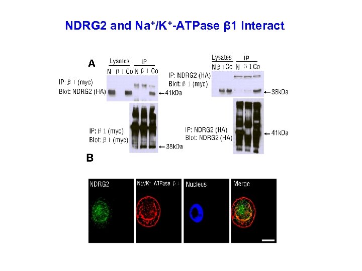 NDRG 2 and Na+/K+-ATPase β 1 Interact 