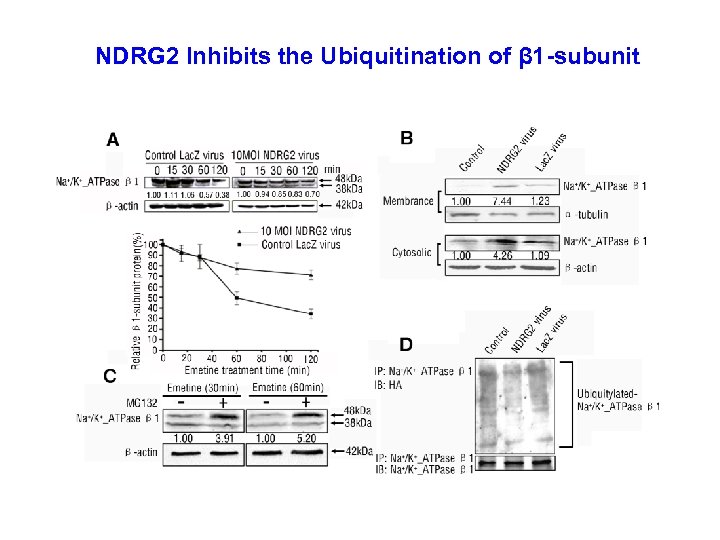 NDRG 2 Inhibits the Ubiquitination of β 1 -subunit 