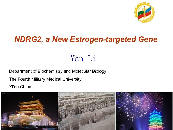 NDRG 2, a New Estrogen-targeted Gene Yan Li Department of Biochemistry and Molecular Biology