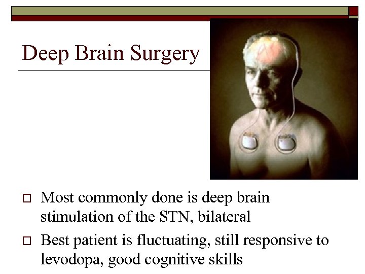 Deep Brain Surgery o o Most commonly done is deep brain stimulation of the