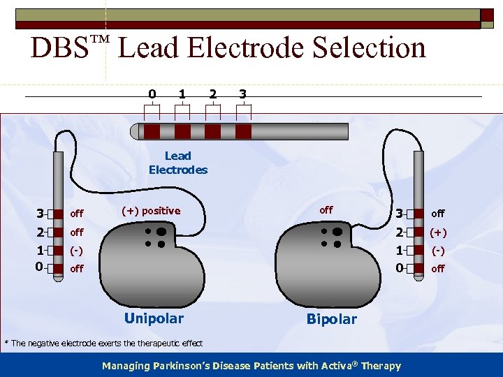 DBS™ Lead Electrode Selection 0 1 2 3 Lead Electrodes 3 2 1 0