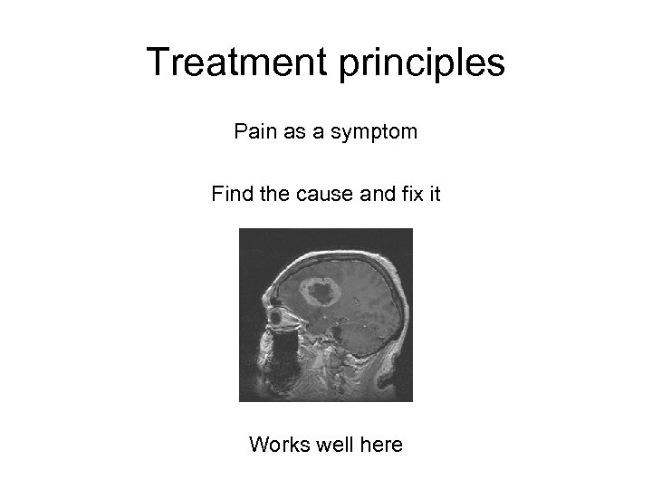 Treatment principles Pain as a symptom Find the cause and fix it Works well