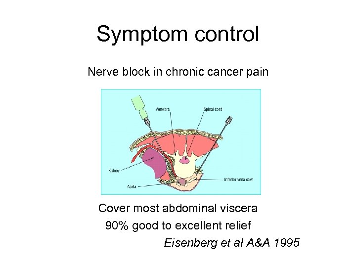 Symptom control Nerve block in chronic cancer pain Cover most abdominal viscera 90% good