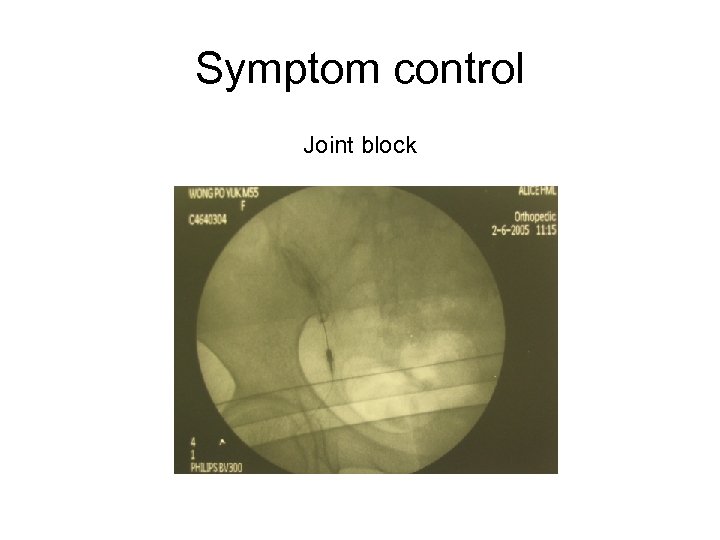 Symptom control Joint block 