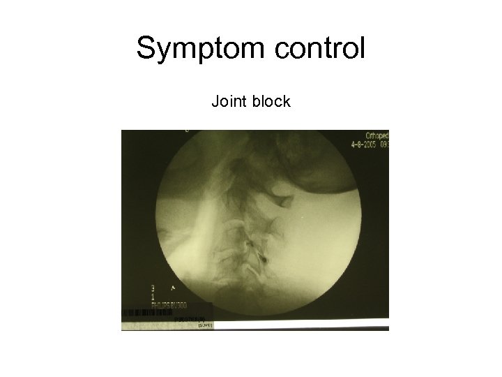 Symptom control Joint block 