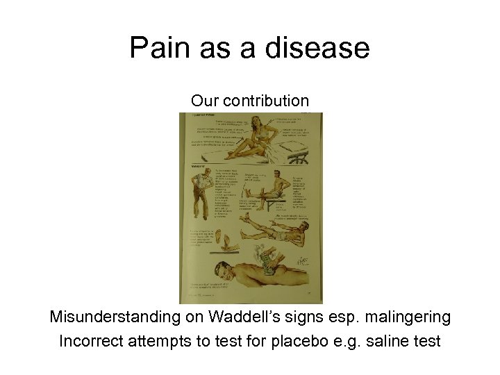 Pain as a disease Our contribution Misunderstanding on Waddell’s signs esp. malingering Incorrect attempts