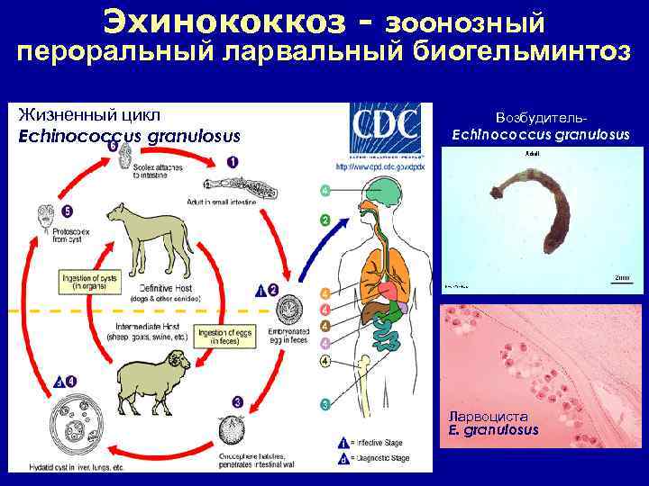 Эхинококкоз - зоонозный пероральный ларвальный биогельминтоз Жизненный цикл Echinococcus granulosus Возбудитель. Echinococcus granulosus Ларвоциста
