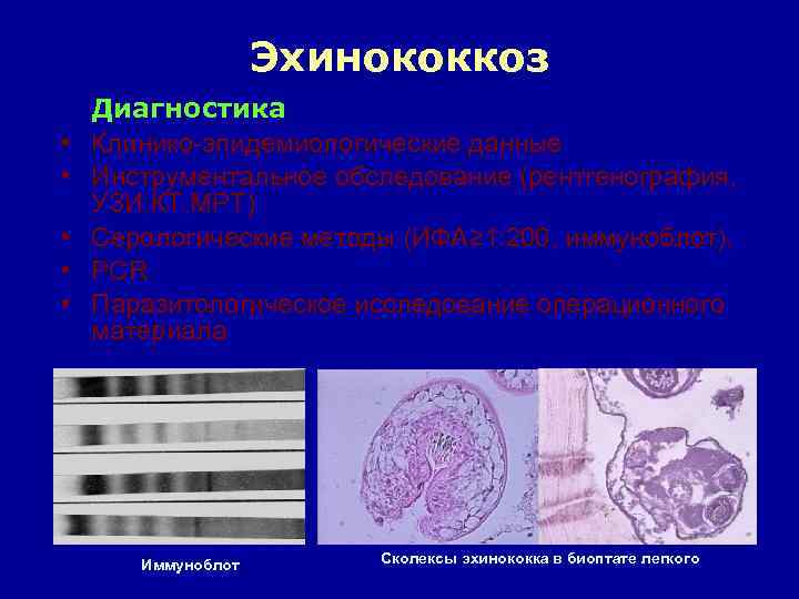Эхинококкоз • • • Диагностика Клинико-эпидемиологические данные Инструментальное обследование (рентгенография, УЗИ, КТ, МРТ) Серологические