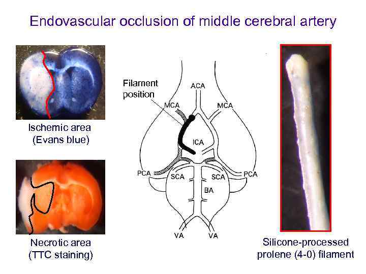 Endovascular occlusion of middle cerebral artery Filament position Ischemic area (Evans blue) Necrotic area