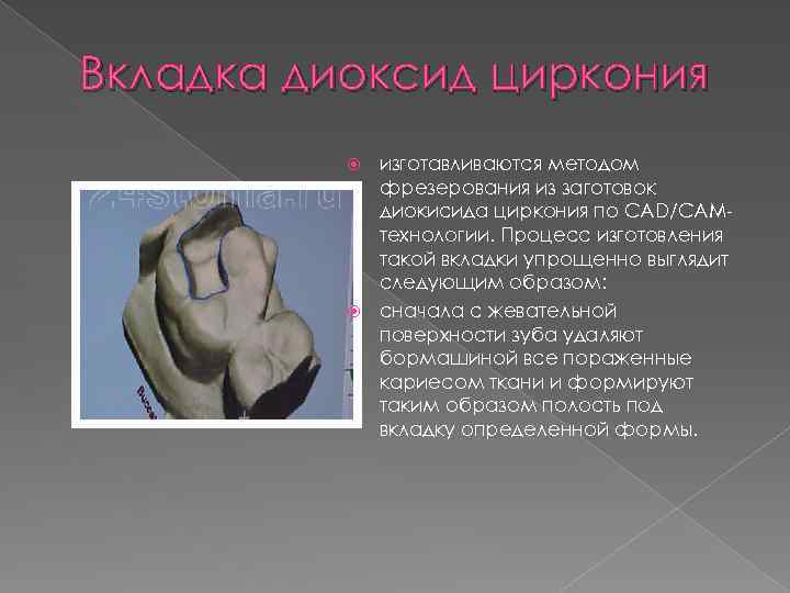 Вкладка диоксид циркония изготавливаются методом фрезерования из заготовок диокисида циркония по CAD/CAMтехнологии. Процесс изготовления