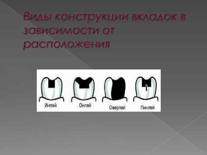 Виды конструкции вкладок в зависимости от расположения 