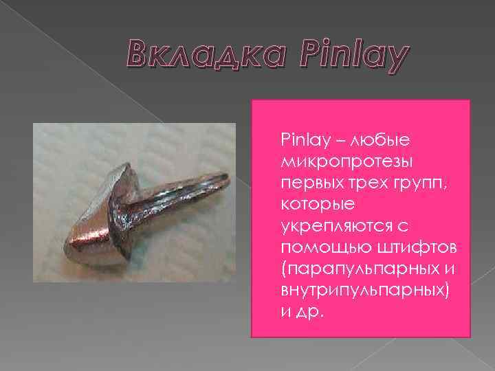 Вкладка Pinlay – любые микропротезы первых трех групп, которые укрепляются с помощью штифтов (парапульпарных