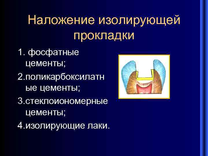 Наложение изолирующей прокладки 1. фосфатные цементы; 2. поликарбоксилатн ые цементы; 3. стеклоиономерные цементы; 4.