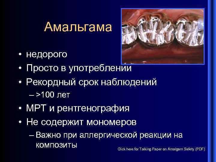 Амальгама • недорого • Просто в употреблении • Рекордный срок наблюдений – >100 лет