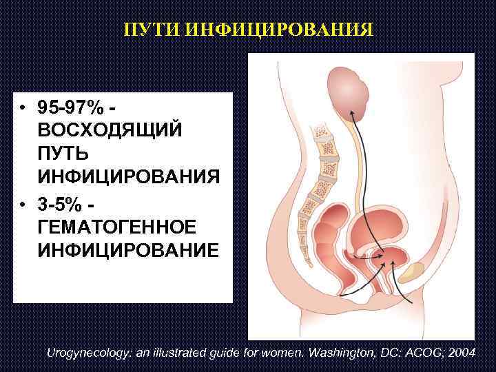ПУТИ ИНФИЦИРОВАНИЯ • 95 -97% - ВОСХОДЯЩИЙ ПУТЬ ИНФИЦИРОВАНИЯ • 3 -5% - ГЕМАТОГЕННОЕ