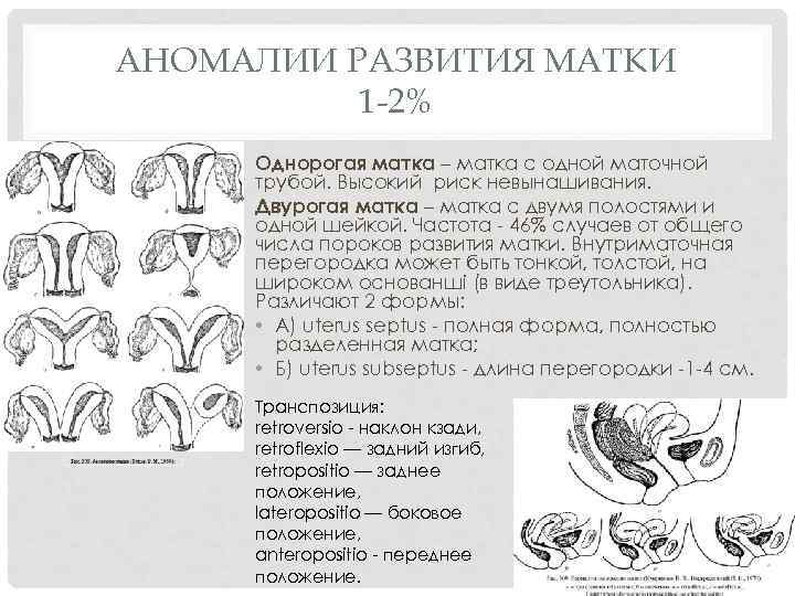 АНОМАЛИИ РАЗВИТИЯ МАТКИ 1 -2% Однорогая матка – матка с одной маточной трубой. Высокий