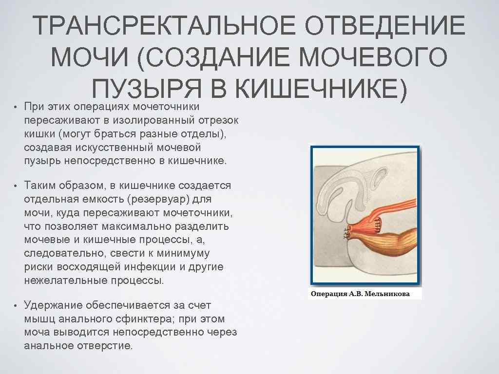  • ТРАНСРЕКТАЛЬНОЕ ОТВЕДЕНИЕ МОЧИ (СОЗДАНИЕ МОЧЕВОГО ПУЗЫРЯ В КИШЕЧНИКЕ) При этих операциях мочеточники