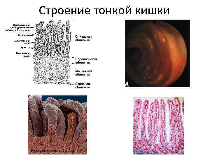 Строение тонкой кишки 