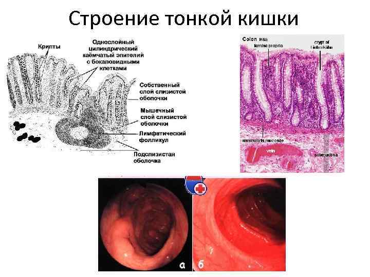 Строение тонкой кишки 