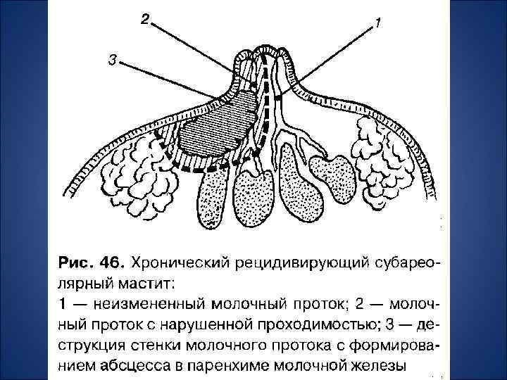 Заболевания молочной железы факультетская хирургия презентация