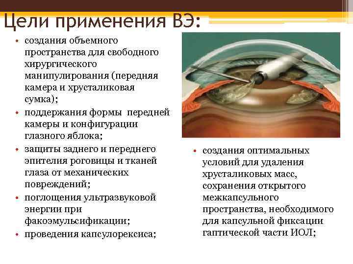 Применение в целях безопасности. Этапы факоэмульсификация катаракты. Протокол операции факоэмульсификации катаракты. Ультразвуковая рукоятка для факоэмульсификации. Факоэмульсификация преимущества.