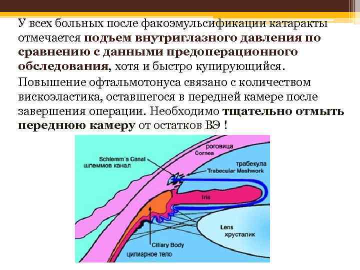 У всех больных после факоэмульсификации катаракты отмечается подъем внутриглазного давления по сравнению с данными