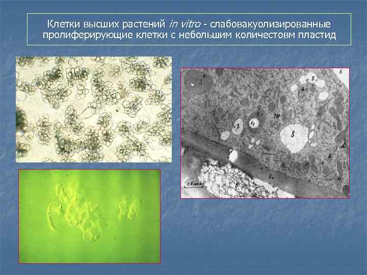 Клетки высших растений in vitro - слабовакуолизированные пролиферирующие клетки с небольшим количестовм пластид 