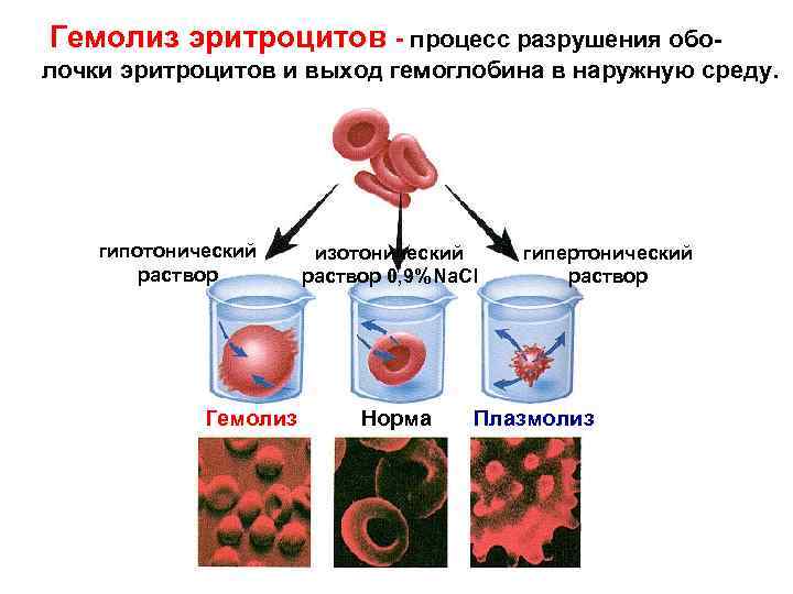 Определение степени липемии иктеричности и гемолиза образца