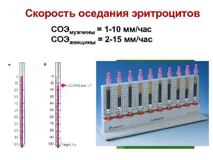 Скорость оседания эритроцитов метод