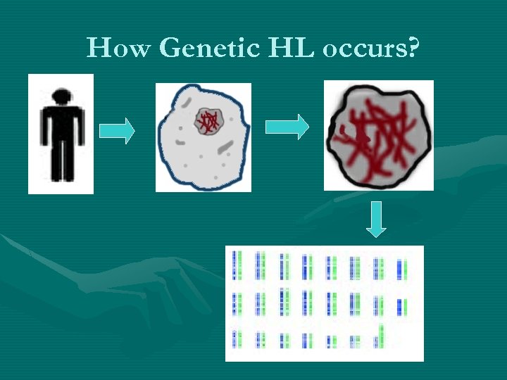 How Genetic HL occurs? 