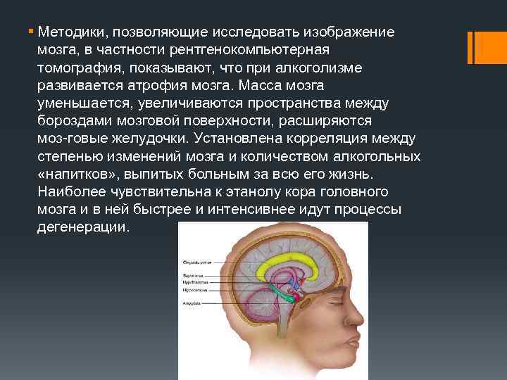 § Методики, позволяющие исследовать изображение мозга, в частности рентгенокомпьютерная томография, показывают, что при алкоголизме