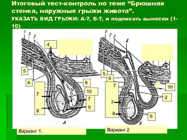 Итоговый тест-контроль по теме “Брюшная стенка, наружные грыжи живота”. УКАЗАТЬ ВИД ГРЫЖИ: А-? ,