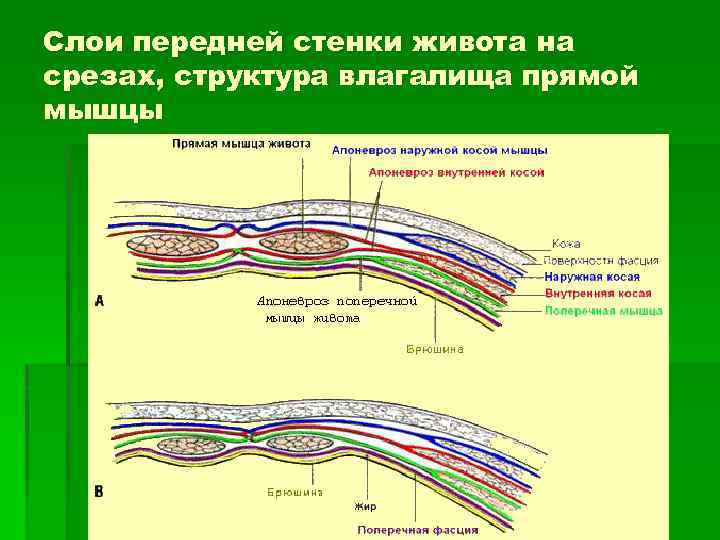 Слои передней стенки живота на срезах, структура влагалища прямой мышцы 